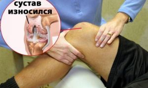 Боль в коленном суставе лечение